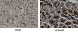 MCAM/CD146 Antibody (MUC18/1130), Novus Biologicals:Antibodies:Primary