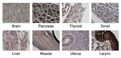 MCAM/CD146 Antibody (MUC18/1130), Novus Biologicals:Antibodies:Primary