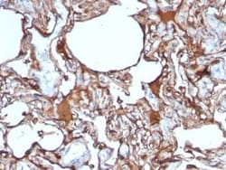 MCAM/CD146 Antibody (SPM620), Novus Biologicals:Antibodies:Primary Antibodies