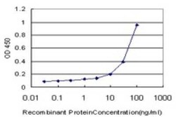 MCAT Antibody (2F2), Novus Biologicals 0.1 mg, Unconjugated:Antibodies,