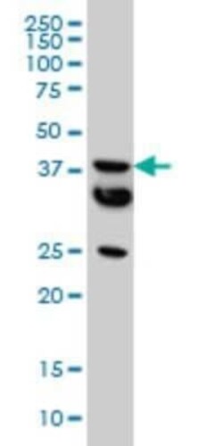 MCAT Antibody (2F2), Novus Biologicals 0.1 mg, Unconjugated:Antibodies,