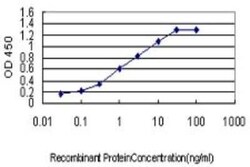MCC Antibody (1A7), Novus Biologicals 0.1 mg | Buy Online | Novus Biologicals | Fisher Scientific