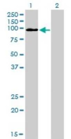 MCC Antibody (1A7), Novus Biologicals 0.1 mg | Buy Online | Novus Biologicals | Fisher Scientific