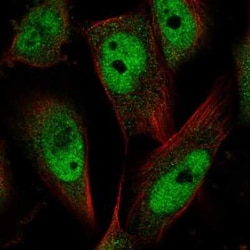 MCC Antibody, Novus Biologicals 25 &mu;L, Unconjugated:Antibodies, Polyclonal