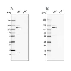 MCC Antibody, Novus Biologicals 25 &mu;L, Unconjugated:Antibodies, Polyclonal