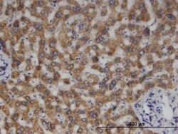 MCCC2 Antibody (2B3), Novus Biologicals 0.1 mg | Buy Online | Novus Biologicals | Fisher Scientific