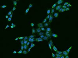 MCCC2 Antibody, Novus Biologicals 50 &mu;g, Unconjugated:Antibodies, Polyclonal