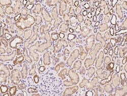 MCCC2 Antibody, Novus Biologicals 50 &mu;g, Unconjugated:Antibodies, Polyclonal