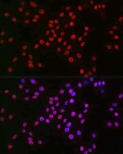 MCM2 Rabbit anti-Human, Mouse, Rat, Clone: 0Q10S9, Novus Biologicals 100