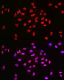 MCM2 Rabbit anti-Human, Mouse, Rat, Clone: 0Q10S9, Novus Biologicals 100