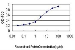 MCM2 Antibody (6A8), Novus Biologicals 0.1 mg | Buy Online | Novus Biologicals | Fisher Scientific