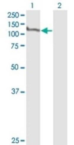 MCM2 Antibody (6A8), Novus Biologicals 0.1 mg | Buy Online | Novus Biologicals | Fisher Scientific