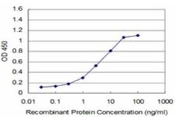 MCM3 Antibody (3E1), Novus Biologicals 0.1 mg | Buy Online | Novus Biologicals | Fisher Scientific
