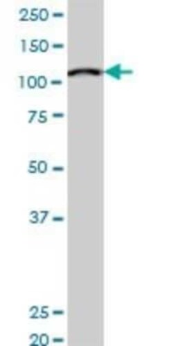 MCM3 Antibody (3E1), Novus Biologicals 0.1 mg | Buy Online | Novus Biologicals | Fisher Scientific