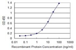 MCM3AP Antibody (1H3), Novus Biologicals 0.1 mg | Buy Online | Novus Biologicals | Fisher Scientific