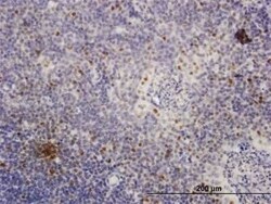 MCM4 Antibody, Novus Biologicals 50 &mu;g | Buy Online | Novus Biologicals | Fisher Scientific