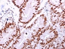 MCM6 Antibody (MCM6/2999) - Azide and BSA Free, Novus Biologicals 100 ug;