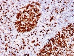 MCM6 Antibody (MCM6/2999) - Azide and BSA Free, Novus Biologicals 100 ug;