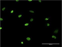 MCM6 Antibody (7D8), Novus Biologicals 0.1 mg, Unconjugated:Antibodies,