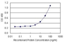 MCM6 Antibody (7D8), Novus Biologicals 0.1 mg, Unconjugated:Antibodies,