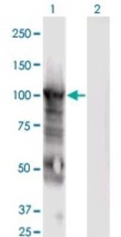 MCM6 Antibody (7D8), Novus Biologicals 0.1 mg, Unconjugated:Antibodies,