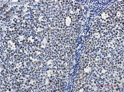 MCM6 Antibody (S02-2I2), Novus Biologicals:Antibodies:Primary Antibodies