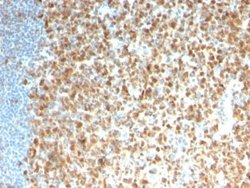 MCM7 Mouse anti-Human, Clone: rMCM7/1468, Novus Biologicals:Antibodies:Primary