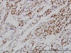 MCM7 Antibody (6C2), Novus Biologicals 0.1 mg | Buy Online | Novus Biologicals | Fisher Scientific
