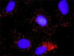 MCM7 Antibody (6C2), Novus Biologicals 0.1 mg | Buy Online | Novus Biologicals | Fisher Scientific