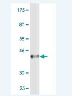 MCPH1 Antibody (6F5), Novus Biologicals 0.1 mg | Buy Online | Novus Biologicals | Fisher Scientific