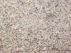 MCRS1 Antibody, Novus Biologicals 0.05 mg | Buy Online | Novus Biologicals | Fisher Scientific