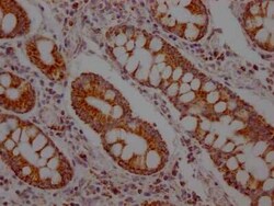 MCT1/SLC16A1 Antibody (9D12), Novus Biologicals 100 &mu;g | Buy Online | Novus Biologicals | Fisher Scientific