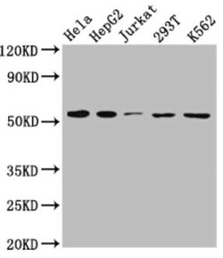 MCT1/SLC16A1 Antibody (9D12), Novus Biologicals 100 &mu;g | Buy Online | Novus Biologicals | Fisher Scientific