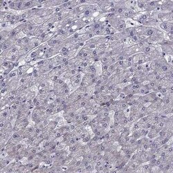 MCT3/SLC16A8 Antibody, Novus Biologicals 25ul; Unconjugated:Antibodies,
