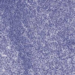 MCT3/SLC16A8 Antibody, Novus Biologicals 25ul; Unconjugated:Antibodies,