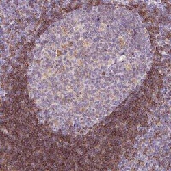 MD-1/LY86 Antibody, Novus Biologicals:Antibodies:Primary Antibodies