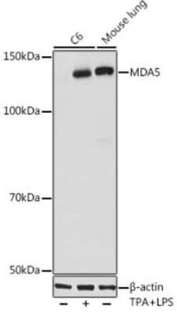 MDA5 Rabbit anti-Human, Mouse, Rat, Clone: 2N8Z5, Novus Biologicals 100 &mu;g | Buy Online | Novus Biologicals | Fisher Scientific
