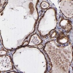 MDA5 Antibody, Novus Biologicals 25 &mu;L; Unconjugated:Antibodies, Polyclonal