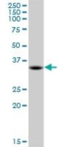MDH1 Antibody (2B11-B7), Novus Biologicals 0.1 mg | Buy Online | Novus Biologicals | Fisher Scientific