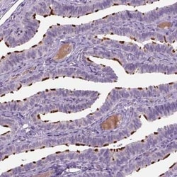 MDH1B Antibody, Novus Biologicals:Antibodies:Primary Antibodies