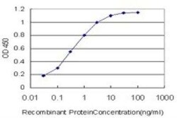 MDM2/HDM2 Antibody (1A7), Novus Biologicals 0.1 mg | Buy Online | Novus Biologicals | Fisher Scientific