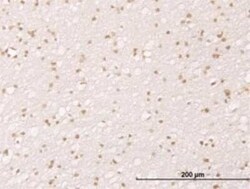 MDM2/HDM2 Antibody (1A7), Novus Biologicals 0.1 mg | Buy Online | Novus Biologicals | Fisher Scientific