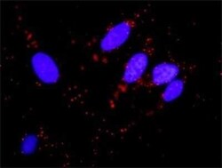 MDM2/HDM2 Antibody (1A7), Novus Biologicals 0.1 mg | Buy Online | Novus Biologicals | Fisher Scientific
