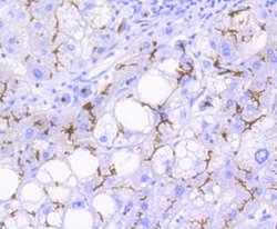 MDR1/ABCB1 Antibody (SN06-42), Novus Biologicals 100&mu;L:Antibodies, Monoclonal