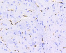 MDR1/ABCB1 Antibody (SN06-42), Novus Biologicals 100&mu;L:Antibodies, Monoclonal