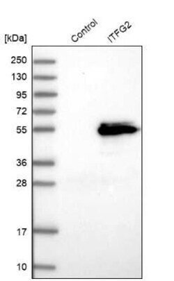 MDS028 Antibody, Novus Biologicals 0.1 mL, Unconjugated:Antibodies, Polyclonal