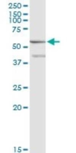 ME1 Antibody (2A2), Novus Biologicals 0.1 mg | Buy Online | Novus Biologicals | Fisher Scientific