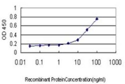 ME1 Antibody (3H5), Novus Biologicals 0.1 mg | Buy Online | Novus Biologicals | Fisher Scientific