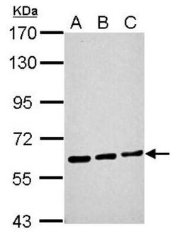 ME1 Antibody, Novus Biologicals 0.1 mL | Buy Online | Novus Biologicals | Fisher Scientific