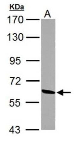 ME1 Antibody, Novus Biologicals 0.1 mL | Buy Online | Novus Biologicals | Fisher Scientific